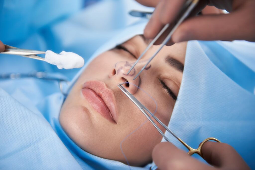 Broken nose surgery to restore nose shape, alignment, and breathing after nasal injury.