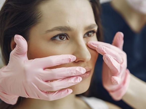 Cosmetic rhinoplasty for improved nose shape and facial balance.