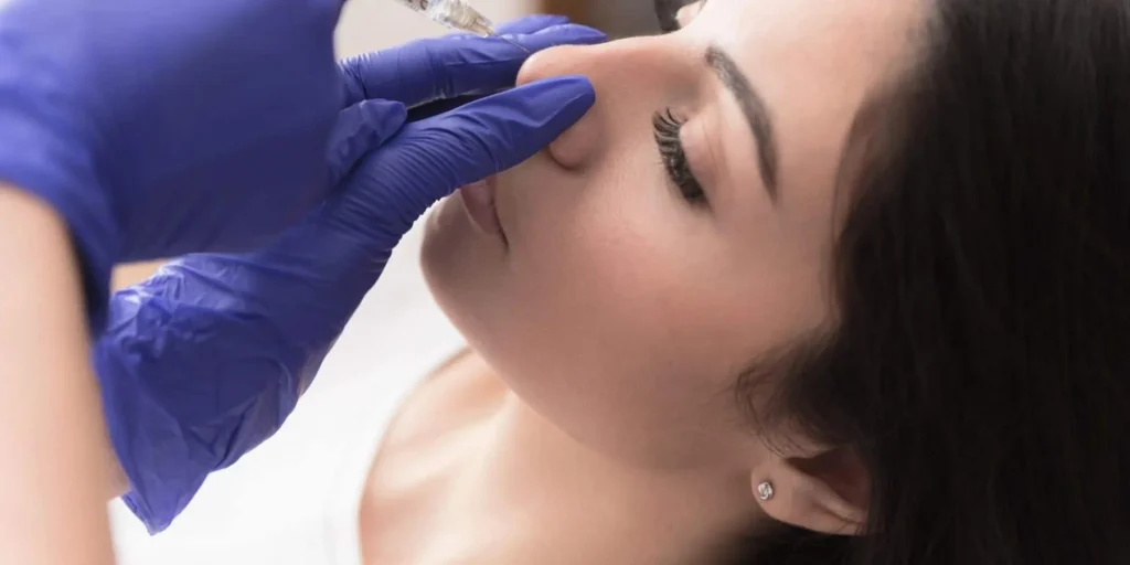 Nose surgery for improved facial profile and balanced nasal features